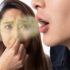 口臭や歯周病菌を抑える新型乳酸菌